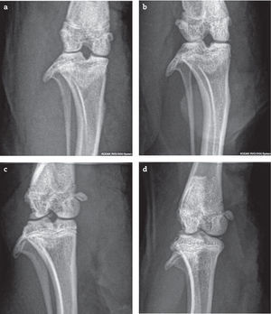 Rayos X de articulación femorotibiorrotuliana en incidencia anteroposterior, a) basal, sin alteraciones (puntaje: 0) b) adyuvante + alendronato temprano (puntaje: 5): anormalidades en carilla articular, osteofitos y esclerosis subcondral. c) adyuvante + alendronato tardío (puntaje 6) presenta anormalidades del contorno óseo, cuerpo libre intrarticular y osteofitos. d) control adyuvante (puntaje: 5), osteofito, fragmento articular y esclerosis subcondral.