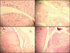 Cortes histopatológicos de la articulación femorotibiorrotuliana teñidos con hematoxilina-eosina con un aumento de 100×. (B) Basal, (Ady) Adyuvante, (Alp) Alendronato preventivo y (Alt) Alendronato tardío. En los grupos Ady, Alp y Alt se observan grados variables de hiperplasia sinovial, estrechamiento del espacio sinovial, daño de cartílago y hueso subcondral y proliferación periostial.