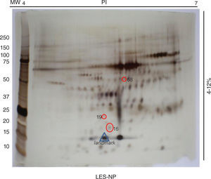Spots seleccionados del perfil proteico de pacientes con lupus eritematoso sistémico neuropsiquiátrico. Gel SDS-PAGE 4–12% de poliacrilamida. El triángulo azul corresponde al punto de referencia (landmark) usado para el análisis comparativo; en círculos rojos se observan los spots con expresión diferencial en muestras de líquido cefalorraquídeo de pacientes con lupus eritematoso sistémico neuropsiquiátrico comparados con los otros grupos de estudio.