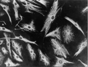 Micrografía de inmunofluorescencia que demuestra la positividad de las células PSC para anticuerpos antivimentina marcados con isotiocianato de fluoresceína. Similar a lo que se encuentra en los fibroblastos43.