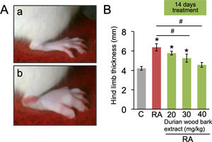 Hind limb thickness in CFA-induced RA model in rats. (A) Representative image of rat hind limb; (a) control; (b) RA model. (B) quantification of hind limb thickness. Data are expressed as a mean±standard deviation (SD). (*) and (#) indicates a significant difference compared to control and between two groups indicated in the graphs (p<0.05), respectively.