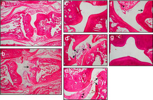 A representative of histopathological images of the ankle joint of rats in the different experimental groups. (a, c) Control group, healthy joint tissue, cartilage, and bone. (b, d) RA group, there is an infiltration of inflammatory cells (arrowhead), erosive cartilage, and bone destruction (arrow). (e) RA treated with 20mg/kg durian wood bark extract, infiltration of inflammatory cells (arrowhead) and erosion or destruction of cartilage still present (arrow). (f) RA treated with 30mg/kg durian wood bark extract, minimal infiltration of inflammatory cells (arrowhead) and erosion of cartilage (arrow). (g) RA treated with 40mg/kg durian wood bark extract, no infiltration of inflammatory cells and erosion of cartilage. a and b were magnified at 40×, while the rest were magnified at 1000×.