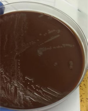 Chocolate blood agar growth medium showed the overgrowth of N. gonorrhoeae.