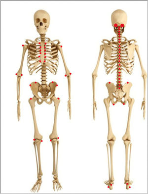 Entheseal sites included in Mander/Newcastle Enthesitis Index (MEI).