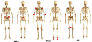 Entheseal sites explored in three clinimetric tools for enthesitis. MASES: Maastricht Ankylosing Spondylitis Enthesitis Index. SPARCC: Spondyloarthritis Research Consortium of Canada. LEI: Leeds Enthesitis Index.