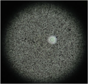 Levadura encapsulada en líquido cefalorraquídeo, tinta china 40×.