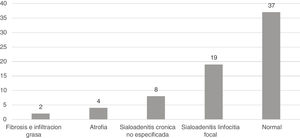 Hallazgos histológicos en 70 biopsias de glándula salival susceptibles de análisis (dos pacientes no fueron susceptibles de análisis).