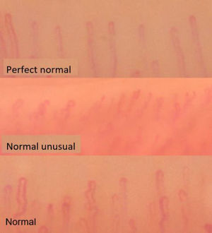 Examples of three normality patterns proposed by Ingegnoli. Images taken from the participants of our study.