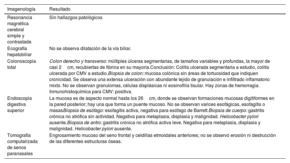 Tablas