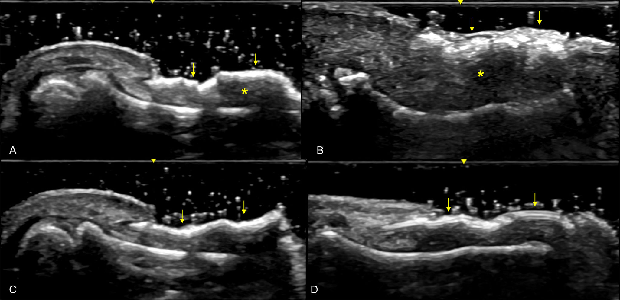 fig0035