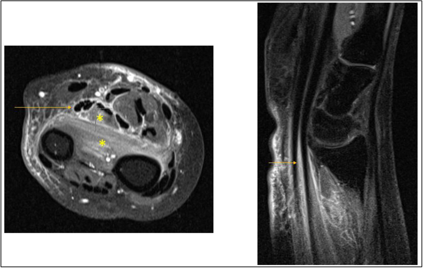 fig0005