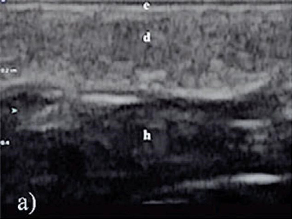 fig0010