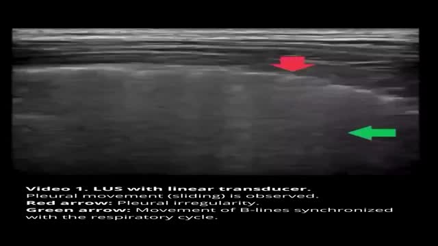 https://ars.els-cdn.com/content/image/1-s2.0-S0121812326000150-mmc1.mp4