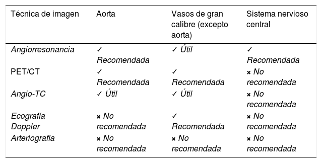 Tablas