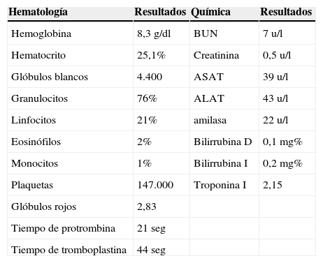 Tablas