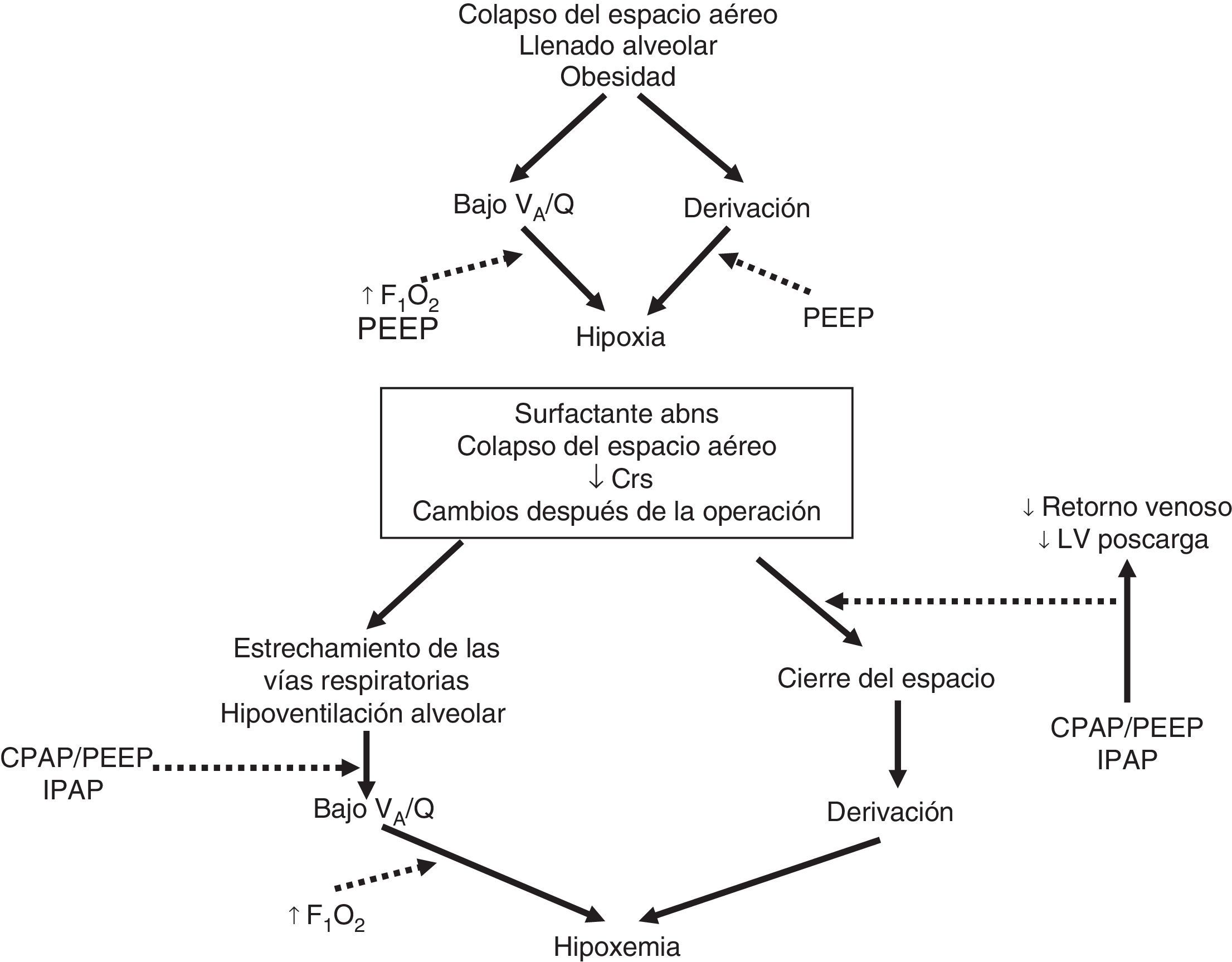 Insuficiencia respiratoria aguda | Acta Colombiana de Cuidado Intensivo