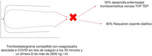 Tromboelastograma de paciente con infección por SARS-CoV-2 con evidencia de coagulopatía dada una disminución de los valores de tiempo R y K, y el aumento de los valores de ángulo alfa y amplitud máxima (MA) sin lisis del coágulo a los 30 min, asociado a dímero-D de más de 2.600 ng/ml. Adaptada de Panigada et al.25.