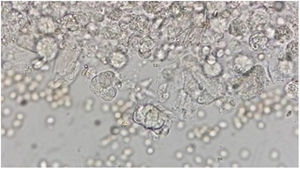 Visualización bajo microscopio de parásito (Lophomona spp.), localizado dentro del círculo.