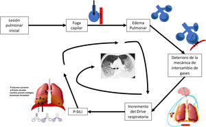 Ilustración de las alteraciones que generan un SDRA desde la lesión pulmonar inicial.P-SILI: lesión pulmonar auto infligida por el paciente; SDRA: síndrome de distrés respiratorio agudo.