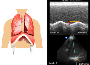 Excursión diafragmática en modo B y M, durante una respiración tranquila.