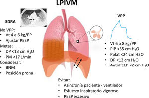 Esquema de las variables que conforman una ventilación protectora pulmonar y diafragmática, así como las medidas a seguir para mantener la ventilación protectora y evitar el LPIVM en pacientes con SDRA. BNM: bloqueo neuromuscular; DP: driving pressure; LPIVM: lesión pulmonar inducida por ventilación mecánica; PEEP: presión positiva al final de la espiración; PIP: presión inspiratoria pico; PM: poder mecánico; Pplat: presión meseta; SDRA: síndrome de distrés respiratorio agudo; VPP: ventilación pulmonar protectora; Vt: volumen tidal.