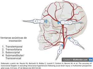 Ultrasonografía Doppler transcraneal71.