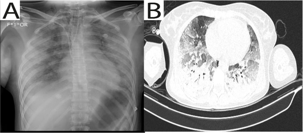 fig0005