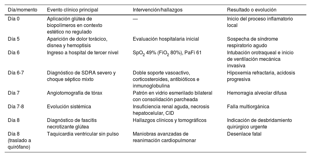 Tablas