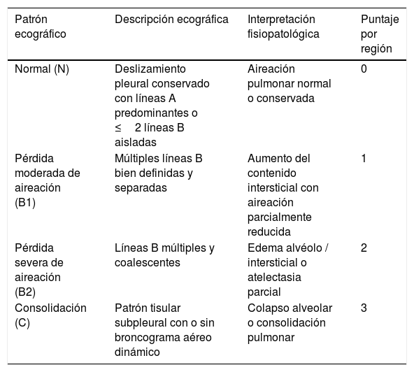 Tablas