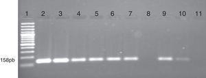 Electroforesis en gel de agarosa que muestra el análisis de metilación del gen DBC1 por MS-PCR en muestras de pacientes con leucemias. Se observa las bandas obtenidas con los cebadores específicos que amplifican las regiones metiladas del promotor del gen. Carril 1 marcador de peso molecular de 100pb (GeneRuler 100bp DNA Ladder, Fermentas). Carril 2 control positivo (ADN metilado universalmente; Epitec control DNA, QIAGEN). Carriles 3 al 7, 9 y 10 corresponde a pacientes con metilación del gen DBC1. Carril 8 paciente que no presenta metilación y carril 11 control negativo (sin DNA).