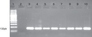 Electroforesis en gel de agarosa que muestra el análisis de metilación del gen CDKN2B por MS-PCR en muestras de pacientes con leucemias. Se observa las bandas obtenidas con los cebadores específicos que amplifican las regiones metiladas del promotor del gen. Carril 1 marcador de peso molecular de 100pb (GeneRuler 100bp DNA Ladder, Fermentas). Carril 2 control negativo (sin DNA). Carril 3 control positivo (ADN metilado universalmente; Epitec control DNA, QIAGEN). Carriles 4 al 10 corresponde a pacientes con metilación del gen CDKN2B.