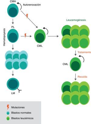 Hematopoyesis y leucemogénesis de la LLA. Durante el proceso de hematopoyesis las células madre hematopoyéticas (CMH), células con división asimétrica, dan origen a los precursores linfoides (PL) que a su vez dan paso a una expansión de células inmaduras (blastos) para una final diferenciación en linfocitos maduros. En el caso de la leucemogénesis algunas células con poco grado de diferenciación (CMH) acumulan mutaciones que generan alteraciones en el ciclo y en el desarrollo celular. Estas células iniciadoras de la leucemia son denominadas células madre leucemogénicas (CML) debido a que producen una descendencia que se caracteriza por una proliferación anormal y un reclutamiento en estadios tempranos de maduración. Las CML se mantienen gracias a sus características de células madre (autorrenovación y quiescencia) y son las responsables de las recaídas en los pacientes tras los tratamientos. CMH: Célula madre hematopoyética CML: Célula madre leucemogénica PL: Precursor linfoide, LM: Linfocito maduro.