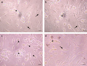 IFN-β protects TG cultured cells from cytopathic effect caused by HSV-1 infection. a. Phase contrast micrographs of TG cultures treated for 6h with 1000U/ml of IFN-β before HSV-1 infection. b. IFN-β untreated and mock infected TG culture. c. IFN-β untreated and HSV-1 infected TG culture. d. TG cultures treated with IFN-β and infected with HSV-1. Note the round and refringent morphology of neurons (*) and the morphology of fibroblasts and Schwann cells (arrows). The virus induced cytopathic effect can be seen in both types of cells (arrow heads). Scale bar represents 40μm. Figure representative of two independent experiments performed.
