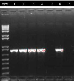 Electroforesis reproceso PCR gen blaKPC. MPM: marcador de peso molecular. Línea 1-4: caso confirmado en paciente 3. Línea 5: paciente colonizado. Línea 6: control positivo. Línea 7: control negativo.