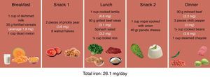Example of diet for a patient with iron deficiency anaemia.