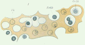 First published sketch of the origin of leukaemic cells, by Ernst C. Neumann. Public domain image, taken from: Wikimedia Commons.