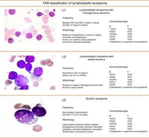 French-American-British (FAB) classification of acute lymphoblastic leukaemia. FAB classification of lymphoblastic leukaemia.