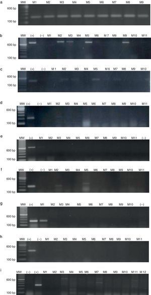 Agarose gel electrophoresis showing RT-PCR quantification of MAGE gene expression in CML patients. (a) GAPDH (217bp), (b) MAGE-A3 (725bp), (c) MAGE-A4 (445bp), (d) MAGE-B2 (230bp), (e) MAGE-C1 (631bp), (f) BAGE-1 (247bp), (g) GAGE-2 (210bp), (h) LAGE-1 (332/561bp), (i) NY-ESO1 (307bp). MW, molecular weight; (+) positive control, testicular tissue; (–)=negative control, healthy individual; M=patients.