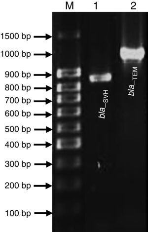 Agarose gel electrophoresis of the PCR products of bla genes in Roseomonas genomospecies 5 UCBU 2191. M: GeneRuler 100bp molecular size marker, 1: bla–SHV (1018bp) and 2: bla–TEM (858bp).