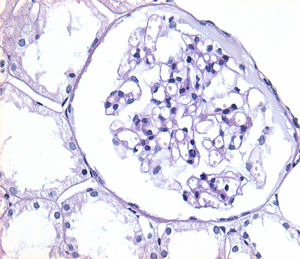 Cut from a case with thin basement membrane disease (TBMD) showing a normal glomerulus, typical of TBMD in optical microscopy. Only some dilated capillary loops are striking. PAS staining, 40×.