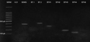 Characterisation panel in cell line MM1.R. The amplification pattern for the genes analysed (cell line MM1.R) is shown: B7-1 (566pb), B7-2 (464pb), B7-H1 (301pb), B7-H2 (102pb), B7-H3 (172pb), B7-H4 (143pb), B7-H6 (143pb). MWM: molecular weight marker. B2MG: β2 microglobulin.