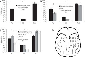 Performance in the naming task in the stimulation of the contacts of the basal mesh: (A) There is a lower performance for the animated LT during stimulation compared to baseline (pre) and 6 months after surgery (p<0.05). (B) It is observed that before the increase of the voltage adds difficulties in the naming of faces (p<0.05). (C) The patient shows increased naming difficulties in animated LT, parts of the body and faces (p<0.05). (D) Contacts that showed difficulties in the naming of animated LT, faces and body parts.