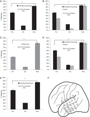 Execution in the naming task in the stimulation of the contacts of the lateral mesh: (A) There is a lower performance in the naming of the animated LT (p<0.05). (B) When the voltage increases, difficulties appear in the denomination of faces (p<0.05). (C) The patient shows deficits in the naming of body parts without showing problems in other categories (p<0.05). (D) The increase in voltage causes greater difficulties in the naming of animate LT and faces but without alterations in the naming of body parts (p<0.05). (E) Decrease in the naming percentage of the animated LT domain with no affection in other categories (p<0.05). (F) Contacts in which the patient presented naming deficits on faces, animated LT and body parts.