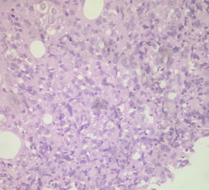Microphotograph of haematoxylin/eosin stain.