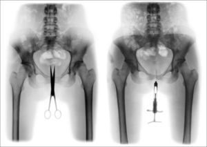 Cris Bierrenbach. De la serie “Retrato íntimo”, 2003