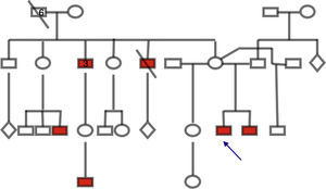Árbol genealógico que demuestra varones afectados en 3 generaciones emparentados por vía materna (en rojo), compatible con herencia ligada a X. La flecha muestra el caso índice.
