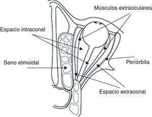 Representación esquemática de la órbita, donde se aprecia la estrecha relación del seno etmoidal con la órbita. La periórbita se encuentra adherida a las paredes óseas y es una barrera eficaz contra las infecciones.