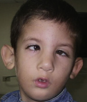 Caso clínico 2. Exploración preoperatoria.