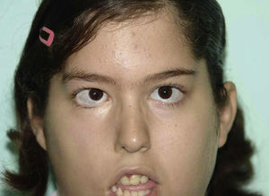 Caso clínico 1. Exploración postoperatoria.