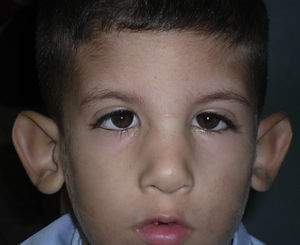 Caso clínico 2. Exploración postoperatoria.